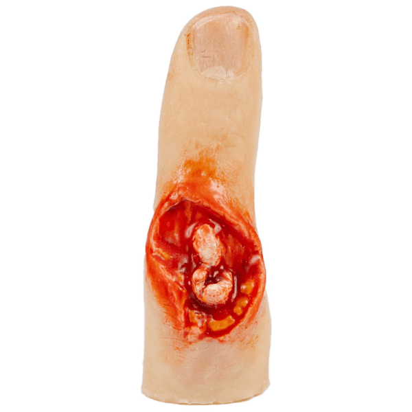 TraumaSim Finger Glove – Exposed Bone Injury